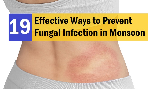 19 Quick and Effective Ways To Prevent Fungal Infection During Humid Weather